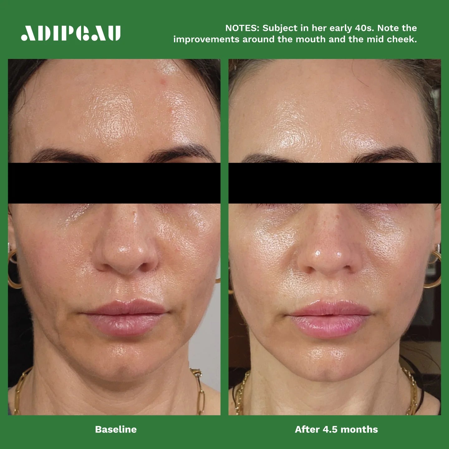 Adipeau Active Face Cream