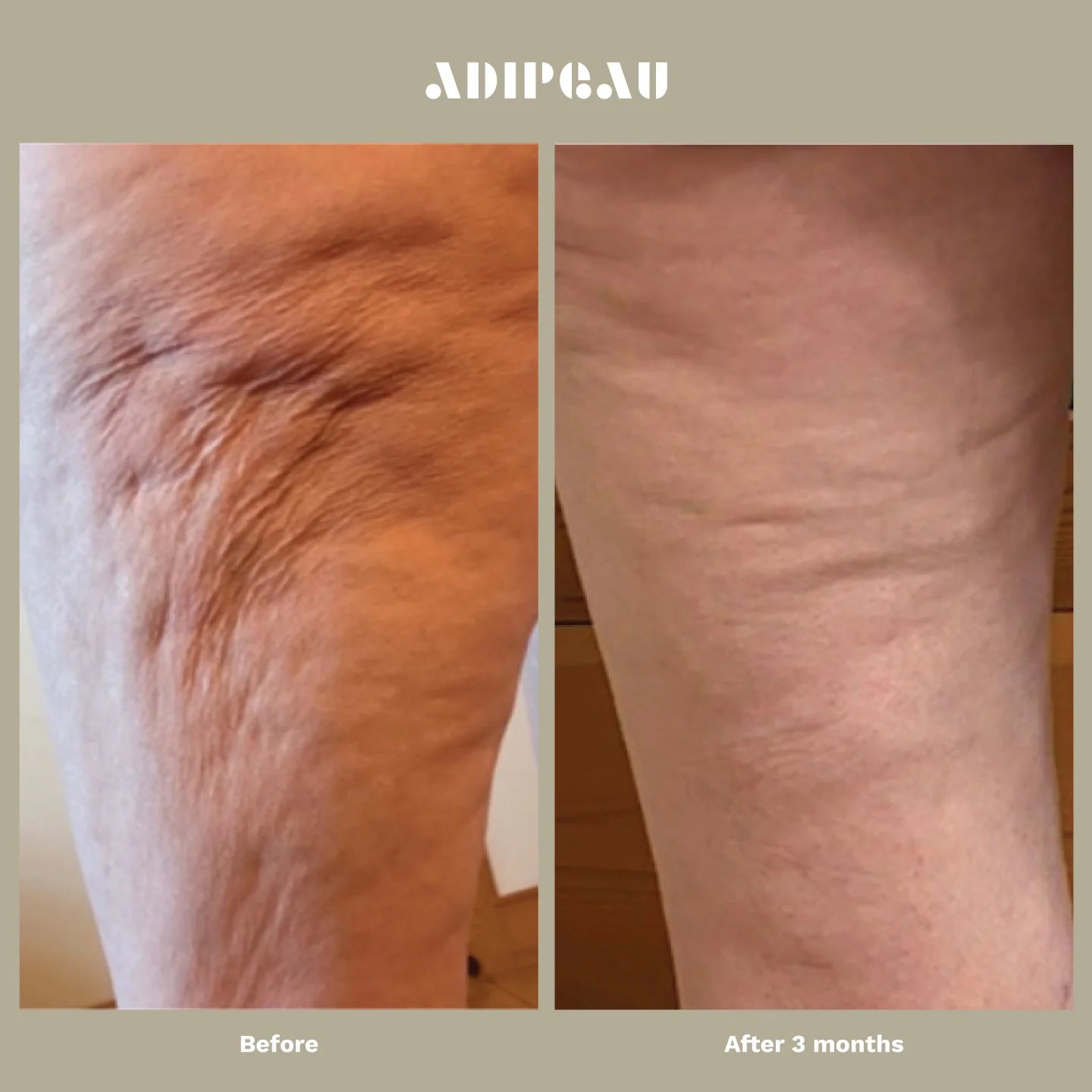 Adipeau Strong Body Gel